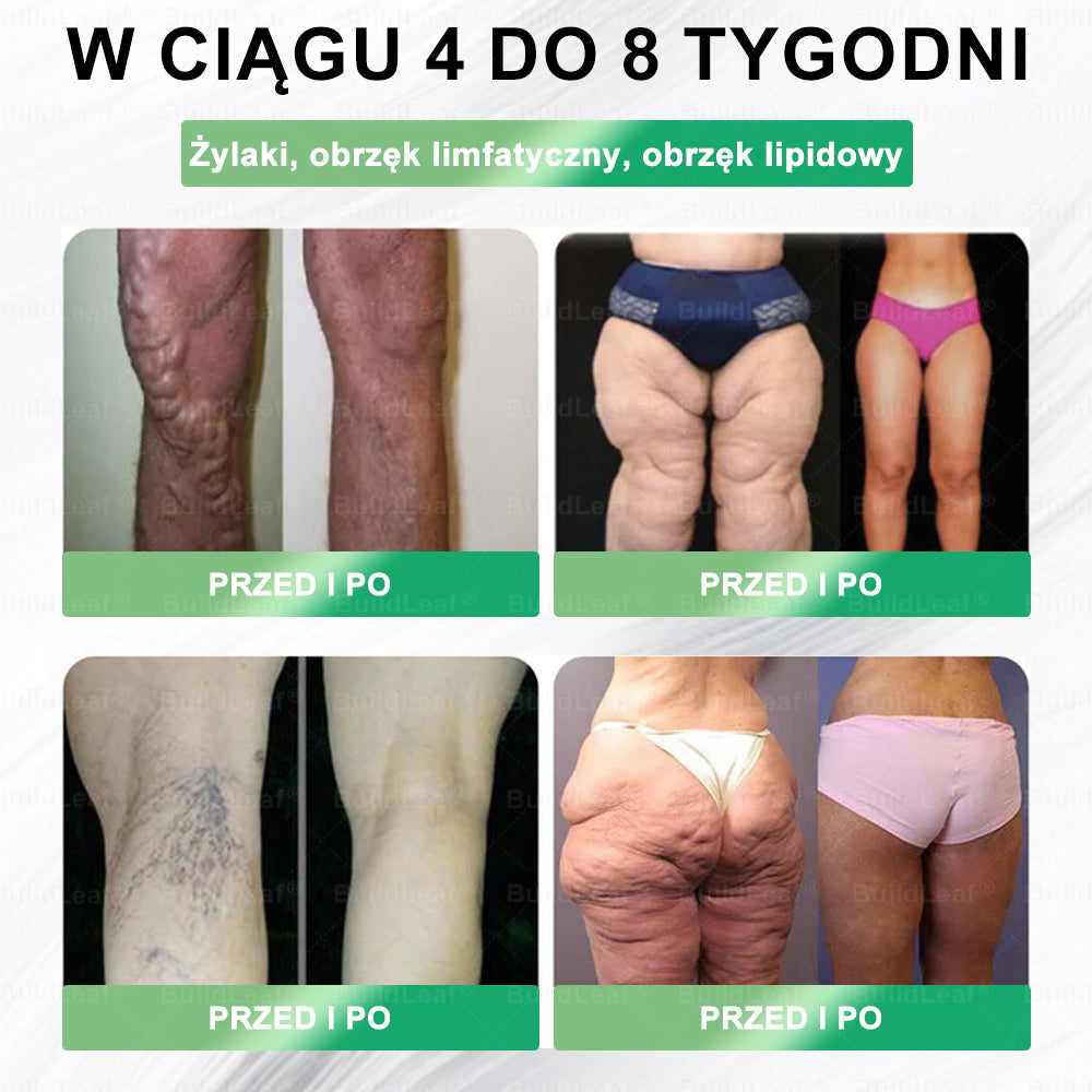 PL Oficjalny Sklep🥇 | BuildLeaf® GLP-1 8-in-1 Fit & Vital Soluzione Orale (Tylko raz dziennie, widoczne efekty już w 7 dni) ✅ Na otyłość, zdrowie sercowo-naczyniowe, cukrzycę, bezdech senny, zdrowie jelit, problemy stawowe i inne