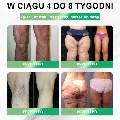 PL Oficjalny Sklep🚚 | BuildLeaf® GLP-1 8-in-1 Fit & Vital Soluzione Orale (Tylko raz dziennie, widoczne efekty już w 7 dni) ✅ Na otyłość, zdrowie sercowo-naczyniowe, cukrzycę, bezdech senny, zdrowie jelit, problemy stawowe i inne